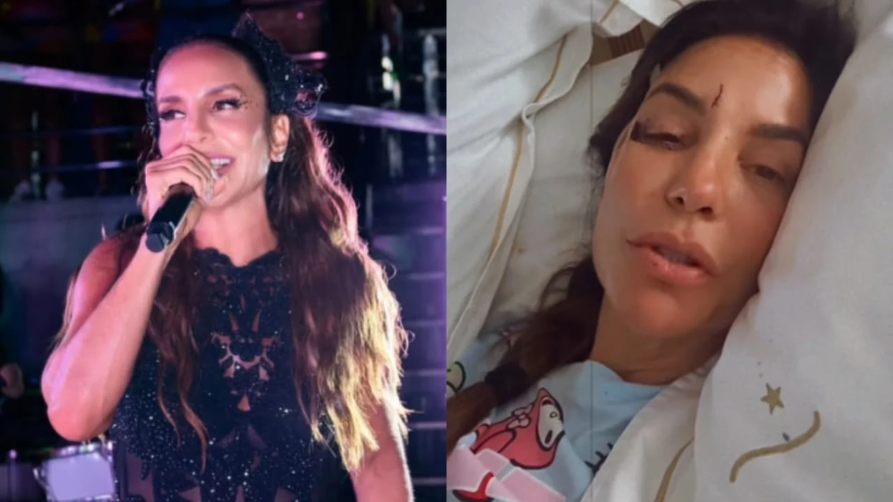 Ivete Sangalo surge com rosto ferido em hospital e explica estado de saúde: ‘Caí com tudo’