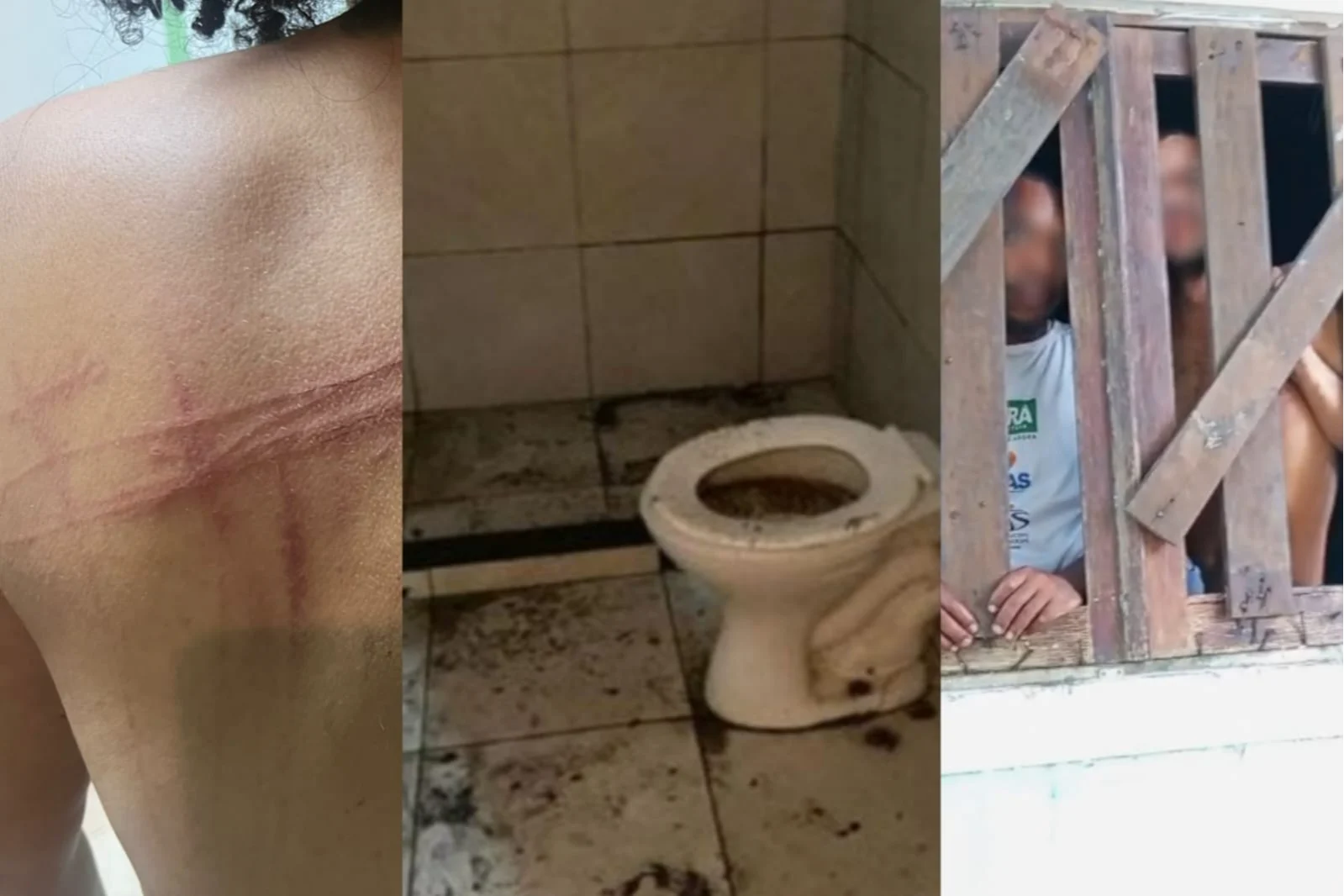 ‘Ali era um massacre’: Ex-internos denunciam tortura e fome em centro terapêutico na Bahia