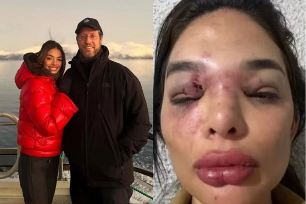 Dentista de 27 anos relata anos de agressões e violência sexual atribuídas ao marido, empresário da Faria Lima