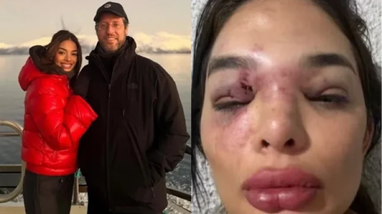 Dentista de 27 anos relata anos de agressões e violência sexual atribuídas ao marido, empresário da Faria Lima