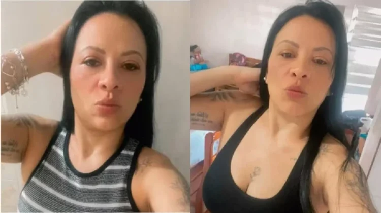 Mulher de 41 anos morre após ter intestino perfurado durante colonoscopia; hospital abre sindicância